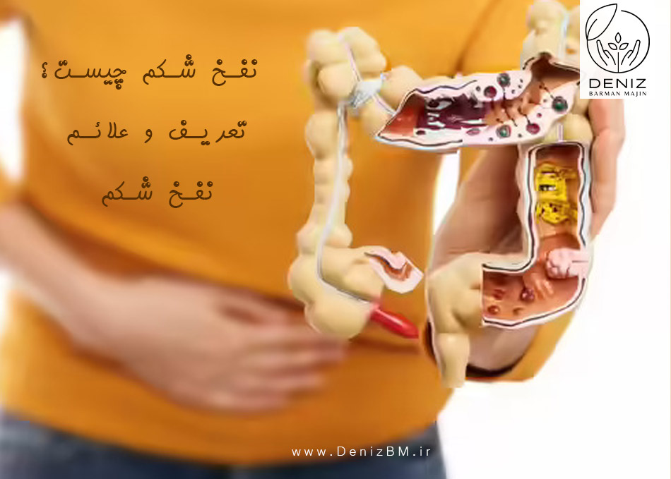 نفخ شکم چیست؟ تعریف و علائم نفخ شکم