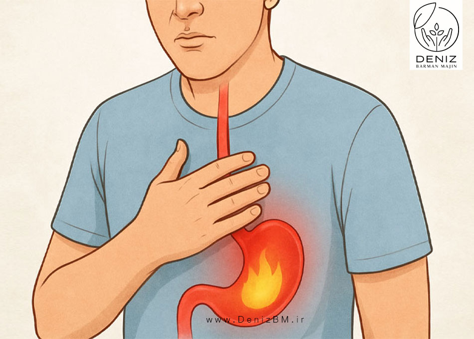 درمان رفلاکس معده: روشهای موثر و علمی برای کنترل اسید و رفع علائم بیماری